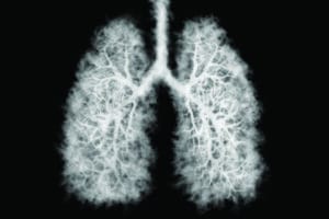 Illustration of a toxic smoke in Lung