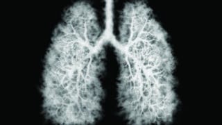 Illustration of a toxic smoke in Lung